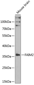 Anti-FAIM2 Antibody (CAB6152)