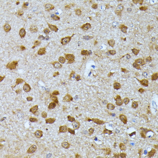 Anti-UBC Antibody (CAB3207)