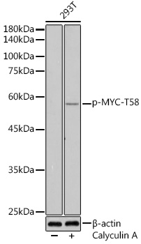 Anti-Phospho-MYC-T58 Antibody (CABP0080)