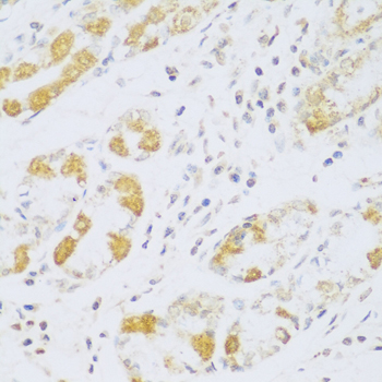 Anti-FDXR Antibody (CAB3860)