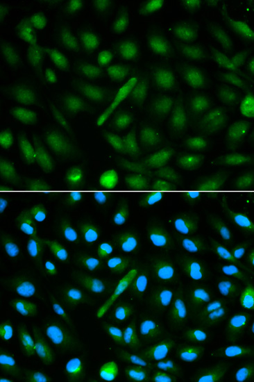 Anti-AHSG Antibody (CAB1647)