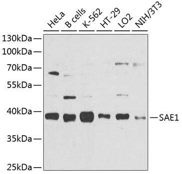 Anti-SAE1 Polyclonal Antibody (CAB9960)