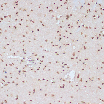 Anti-Phospho-MAPK3-Y204 Antibody (CABP0235)