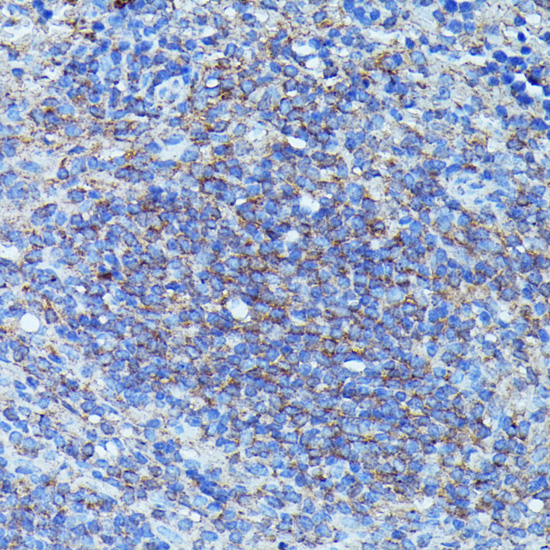 Anti-CSF3 Antibody (CAB6178)