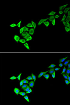 Anti-MECOM Antibody (CAB13669)