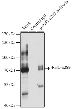 Anti-Phospho-RAF1-S259 Antibody (CABP0497)