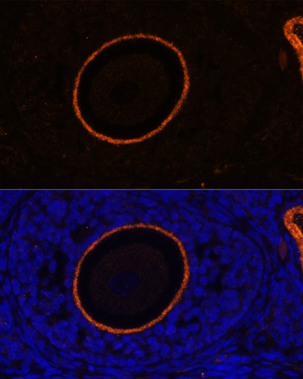 Anti-ZP3 Antibody (CAB13156)