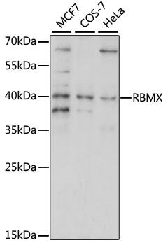 Anti-RBMX Antibody (CAB15436)