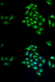 Anti-KLK4 Antibody (CAB6642)