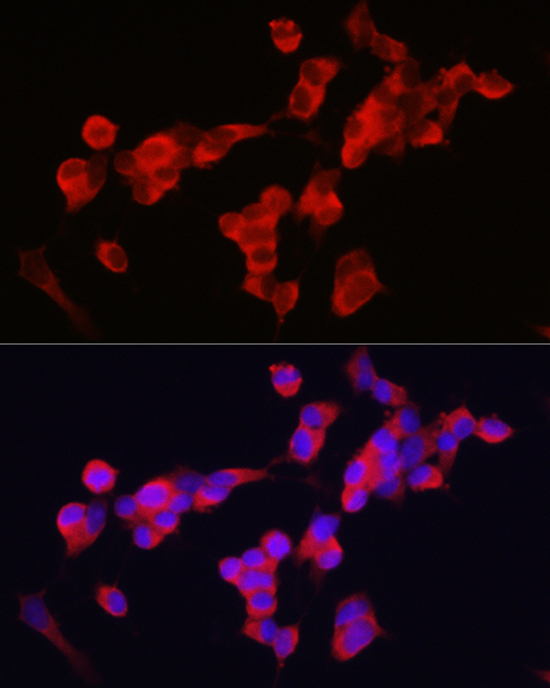 Anti-KIF5A Antibody (CAB3303)