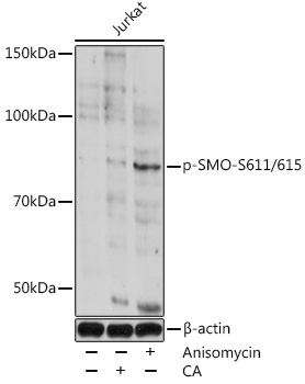 Anti-Phospho-SMO-S611/615 Antibody (CABP0939)