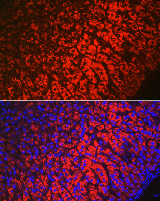 Anti-HSD3B1 Polyclonal Antibody (CAB8035)