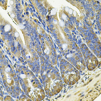 Anti-EIF3C Antibody (CAB7022)