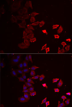 Anti-P2RX4 Antibody (CAB6682)