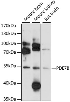 Anti-PDE7B Antibody (CAB12134)