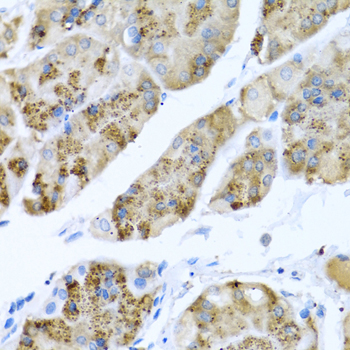 Anti-MGP Antibody (CAB5439)