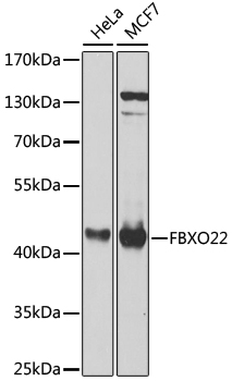 Anti-FBXO22 Polyclonal Antibody (CAB8367)