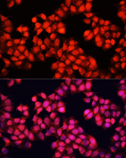 Anti-ALAD Antibody (CAB12395)