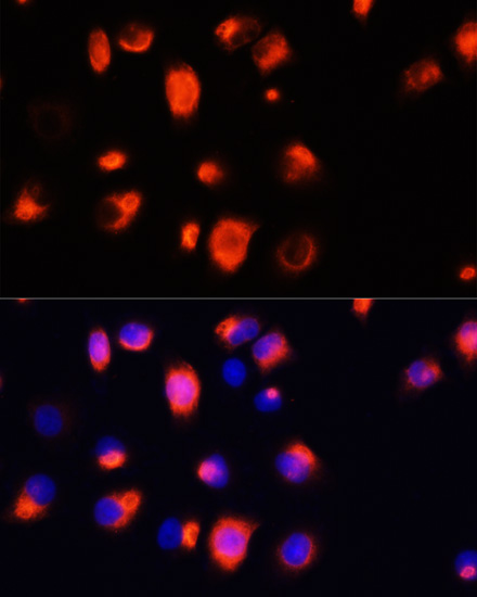 Anti-HO-1 Antibody (CAB11102)