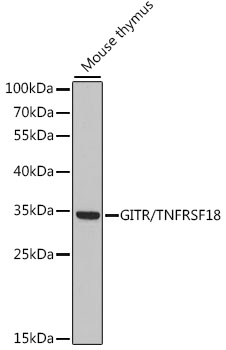 Anti-GITR/TNFRSF18 Antibody (CAB15625)