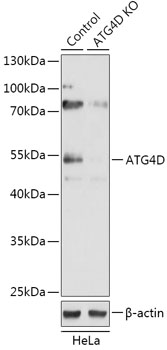 Anti-ATG4D Antibody [KO Validated] (CAB18097)