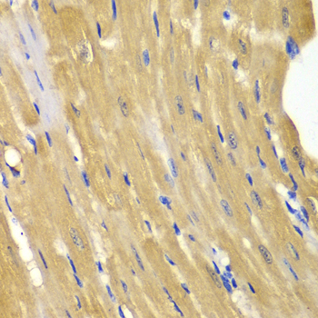 Anti-AK1 Antibody (CAB1218)