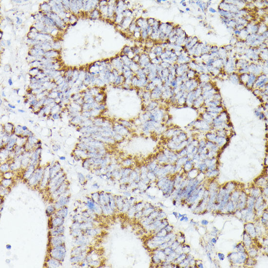 Anti-STAT1 Antibody (CAB12075)