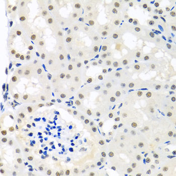 Anti-THOC1 Polyclonal Antibody (CAB8179)