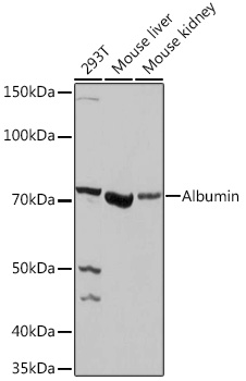 Anti-Albumin Antibody (CAB1363)