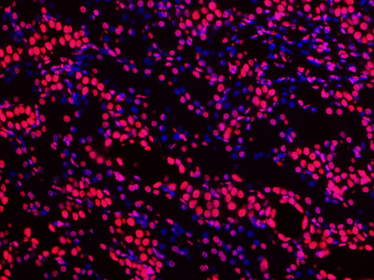 Paraffin embedded rat kidney was treated with DNase I to fragment the DNA. DNA strand breaks showed intense fluorescent staining in DNase I treated sample (red). The cells were counterstained with DAPI (blue).