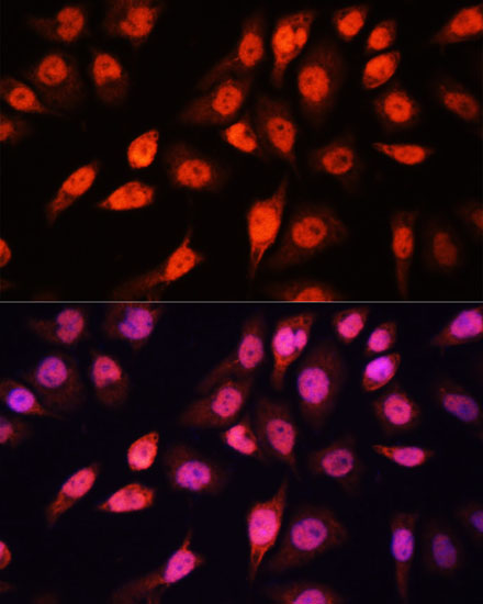 Anti-SOX2 Antibody (CAB11501)