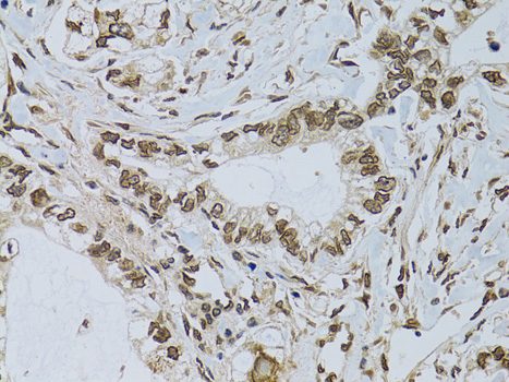 Anti-EMD Antibody (CAB13925)