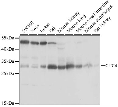 Anti-CLIC4 Antibody (CAB7088)