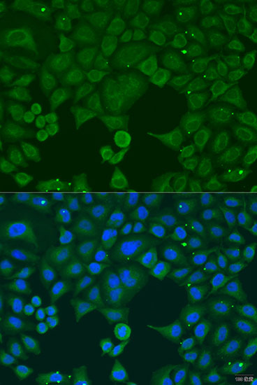 Anti-IFNA4 Polyclonal Antibody (CAB8124)