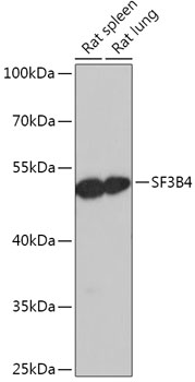 Anti-SF3B4 Antibody (CAB17608)