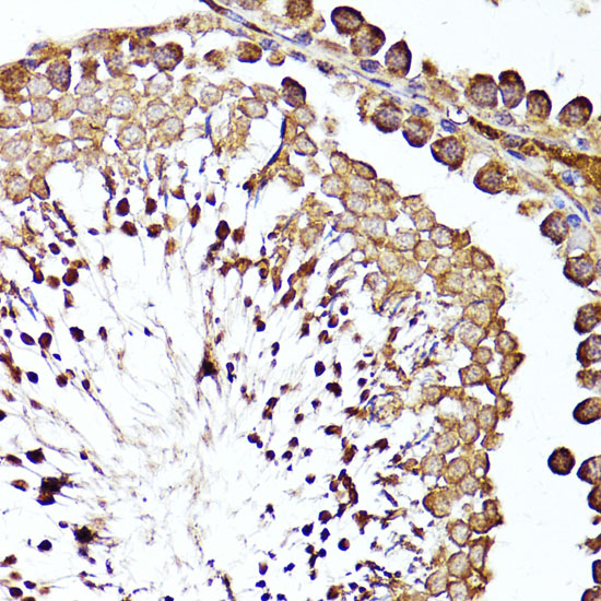 Anti-MME Antibody (CAB5664)