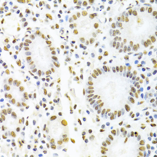 Anti-HNRNPD Antibody (CAB1828)