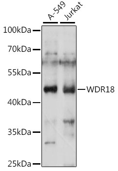 Anti-WDR18 Antibody (CAB15875)