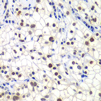 Anti-GTF2F2 Antibody (CAB13497)