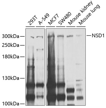 Anti-NSD1 Polyclonal Antibody (CAB9981)