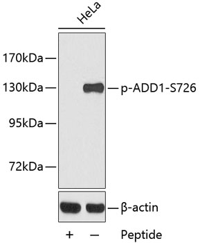 Anti-Phospho-Alpha-adducin-S726 Antibody (CABP0196)