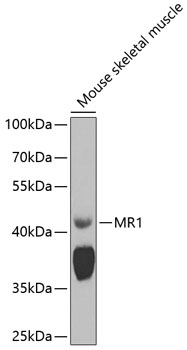 Anti-MR1 Polyclonal Antibody (CAB8051)