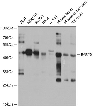 Anti-RGS20 Polyclonal Antibody (CAB8167)