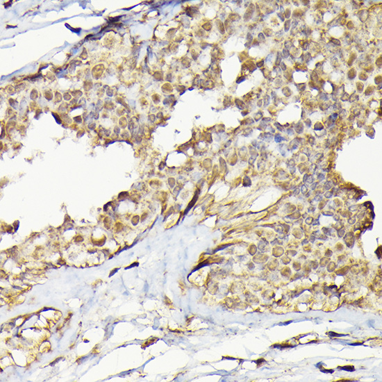 Anti-TARBP2 Antibody (CAB7533)