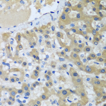 Anti-XPC Polyclonal Antibody (CAB8354)