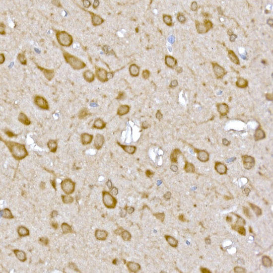 Immunohistochemistry of paraffin-embedded rat brain using CASTOR1 Rabbit pAb at dilution of 1:50 (40x lens). Perform high pressure antigen retrieval with 10 mM citrate buffer pH 6. 0 before commencing with IHC staining protocol.