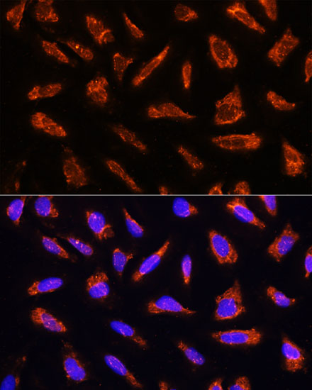 Anti-MFGE8 Antibody (CAB12322)