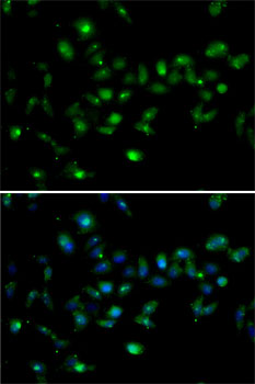 Anti-MORF4L1 Antibody (CAB7071)