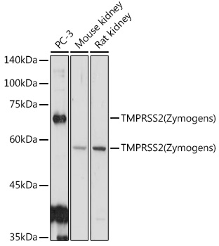 Anti-TMPRSS2 Antibody (CAB1979)