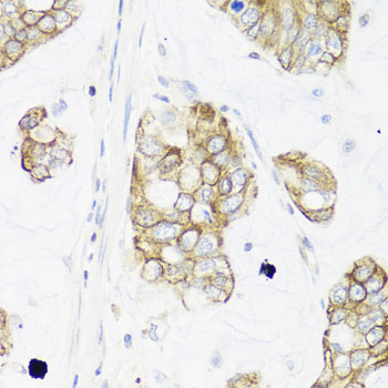 Anti-IER3 Polyclonal Antibody (CAB8566)